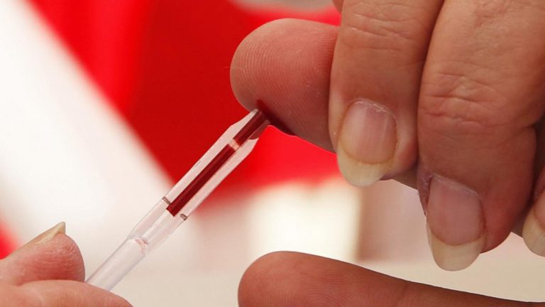 Más de 140 mil personas viven con VIH Sida en la Argentina